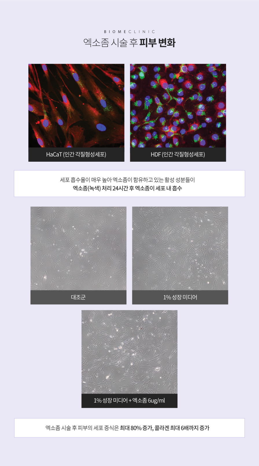 엑소좀 시술 후 피부변화