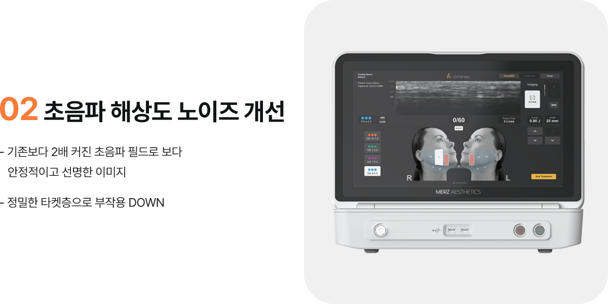 02 초음파 해상도 노이즈 개선