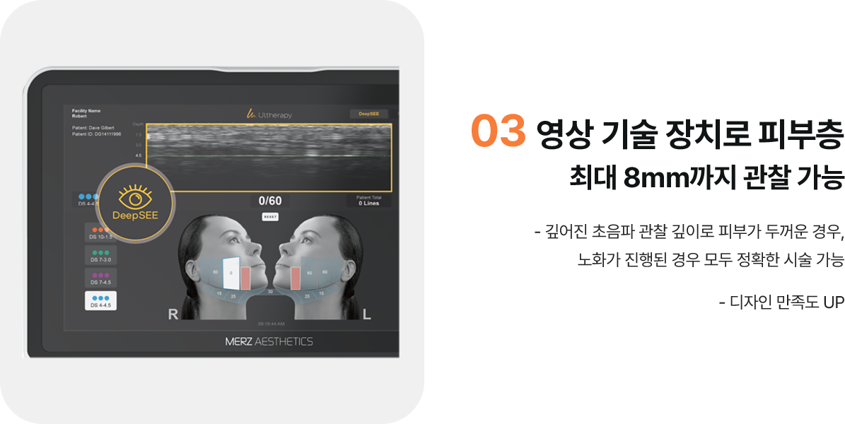 03 영상 기술 장치로 피부층 최대 8mm까지 관찰 가능