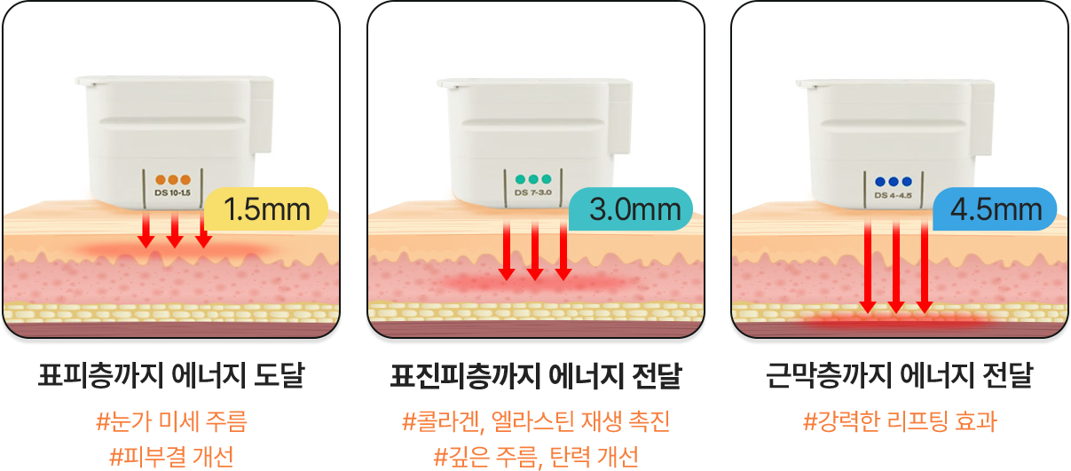 표피층까지 에너지 도달,표진피층까지 에너지 전달,근막층까지 에너지 전달