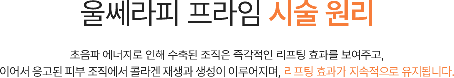 울쎄라피 프라임 시술 원리