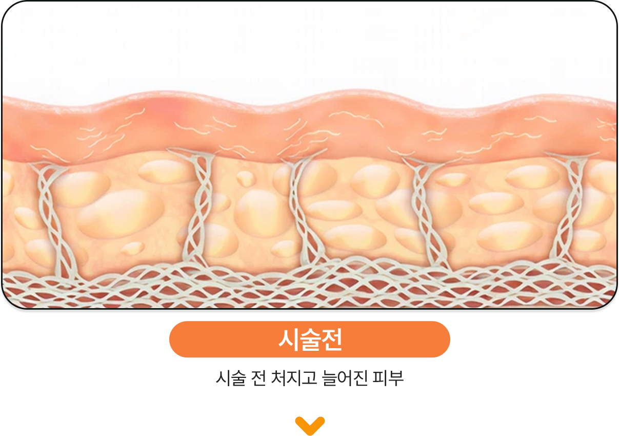 시술전
